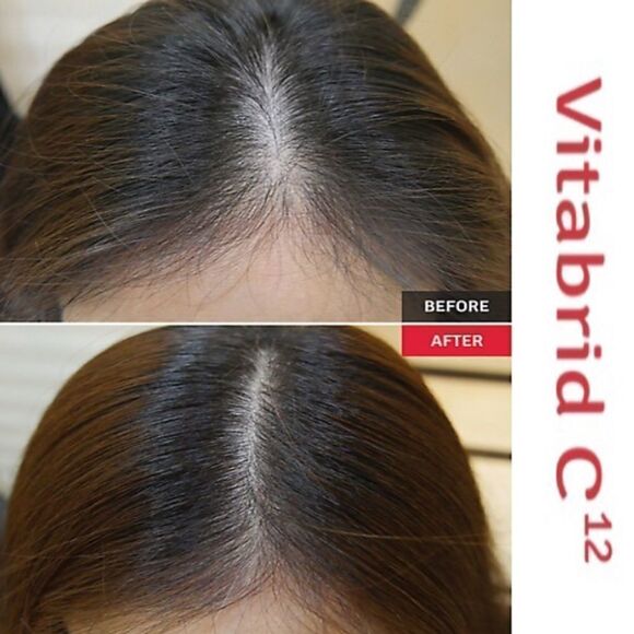 Vitabrid C12 Hair Tonic Professional - Picture 4 of 4